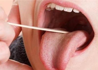 سنگ لوزه گریبانگیر چه کسانی می گردد؟