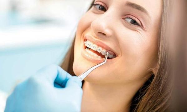 هرآن چیزی که باید درباره ارتودنسی دندان و تمام روش های آن بدانید
